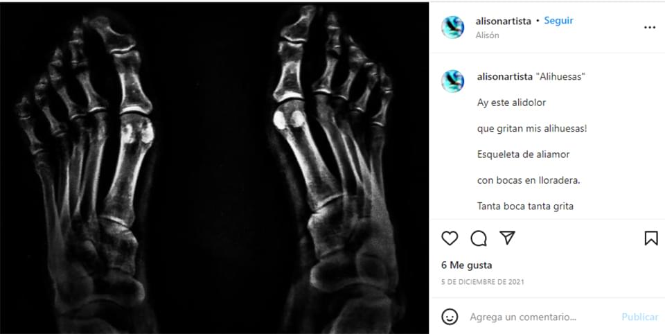 Obra Alihuesas de Alisón de la categoría En Primera Persona